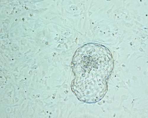 卵巢0.49能做试管：卵巢小做试管婴儿怎么办