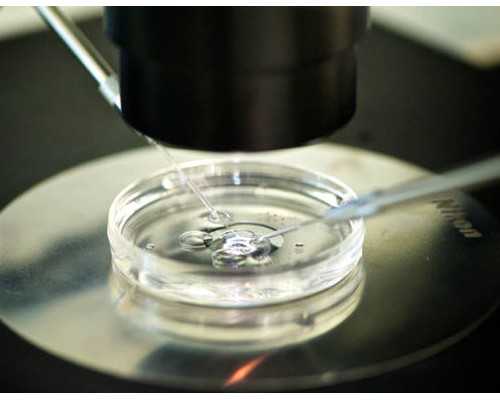 156/49小基数养姨妈高碳饮食记录 Day213 专业供卵试管代孕