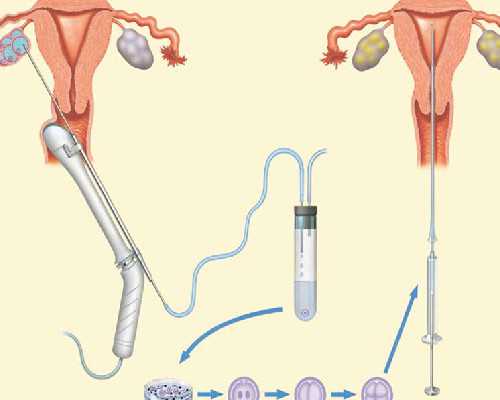 助产机构,验孕试纸一条杠是怀孕了吗
