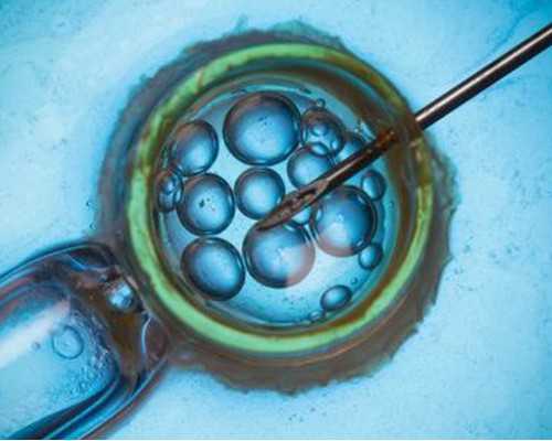 江门染色体异常可以做二代试管婴儿吗(江门试管婴儿的具体流程)，费用各不相同！