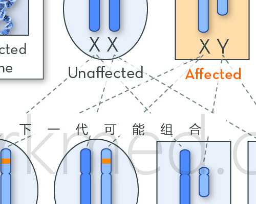 孕期nt检查是什么 哪些人需要接受这一检查 代孕公司费用多少