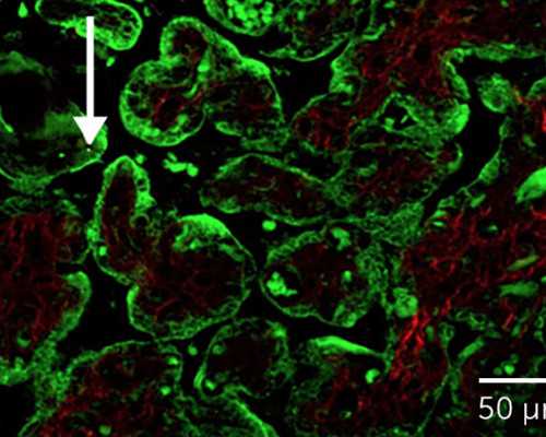 代怀孕价格，美国第三代试管大概多少钱，美国第三代试管婴儿费用及降低策略